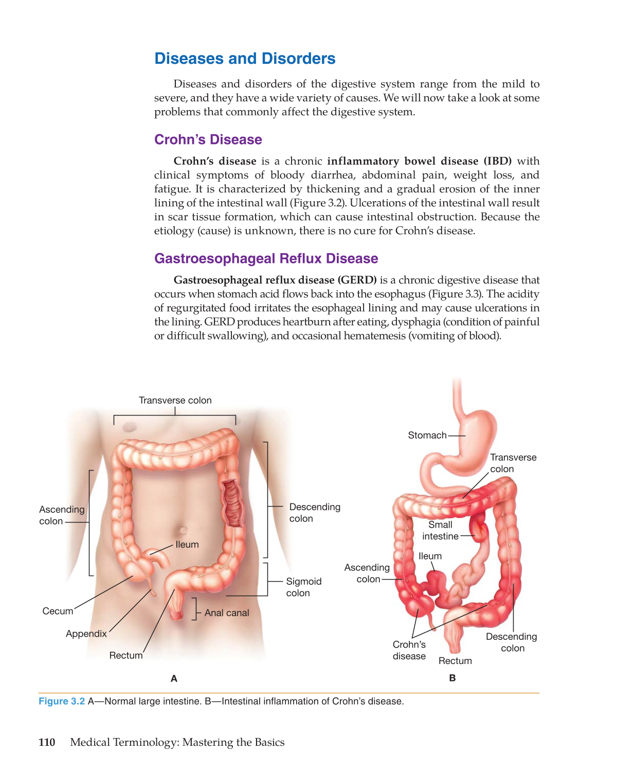Medical Terminology: Mastering the Basics, 1st Edition page 110