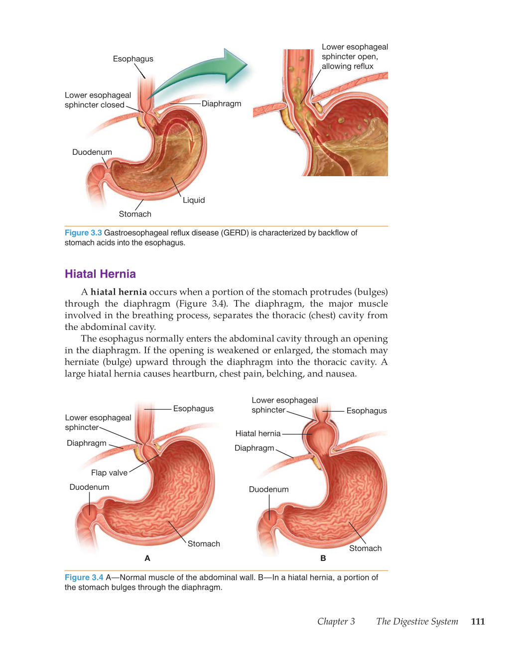 Medical Terminology: Mastering the Basics, 1st Edition page 111