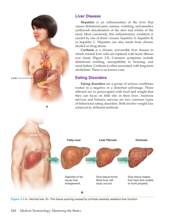 Medical Terminology: Mastering the Basics, 1st Edition page 112