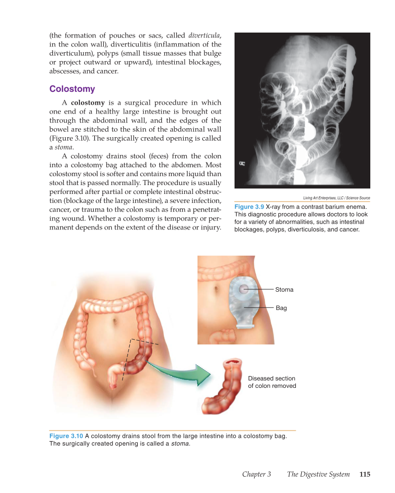 Medical Terminology: Mastering the Basics, 1st Edition page 115
