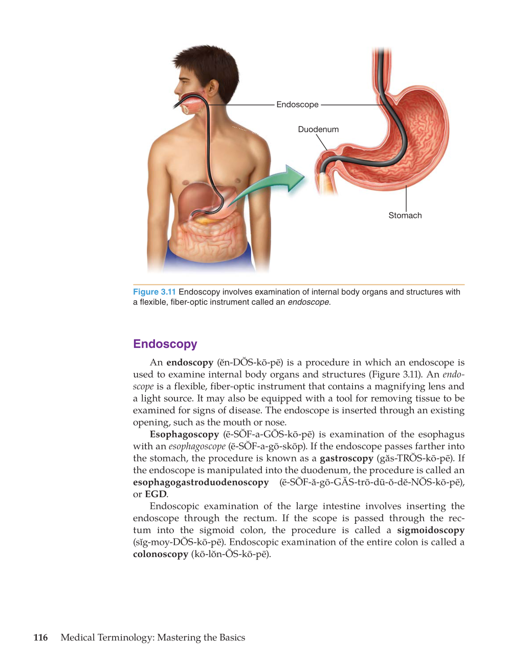 Medical Terminology: Mastering the Basics, 1st Edition page 116