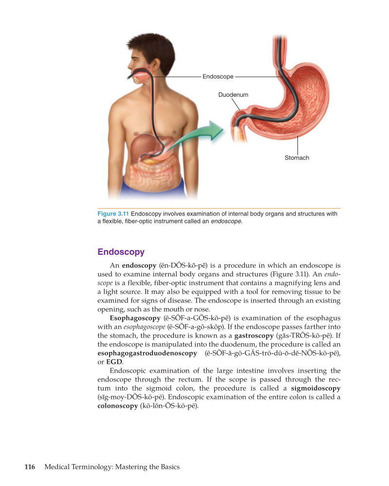 Medical Terminology: Mastering the Basics, 1st Edition page 116
