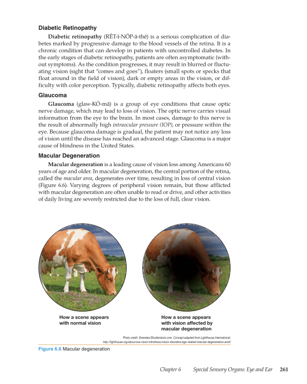 Medical Terminology: Mastering the Basics, 1st Edition page 261