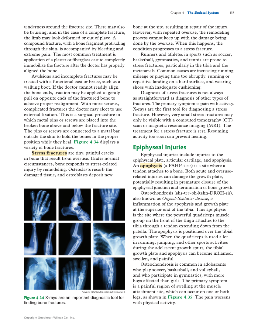 Introduction to Anatomy and Physiology, 2nd Edition page 157