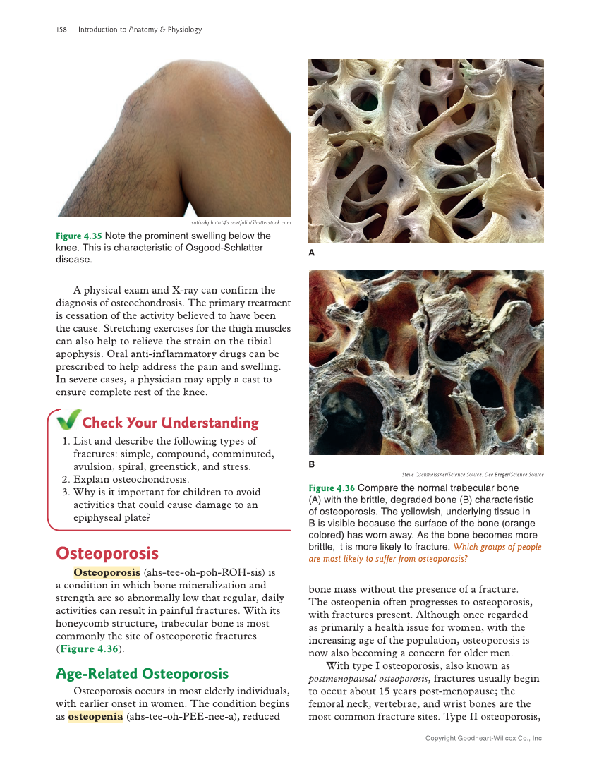 Introduction to Anatomy and Physiology, 2nd Edition page 158